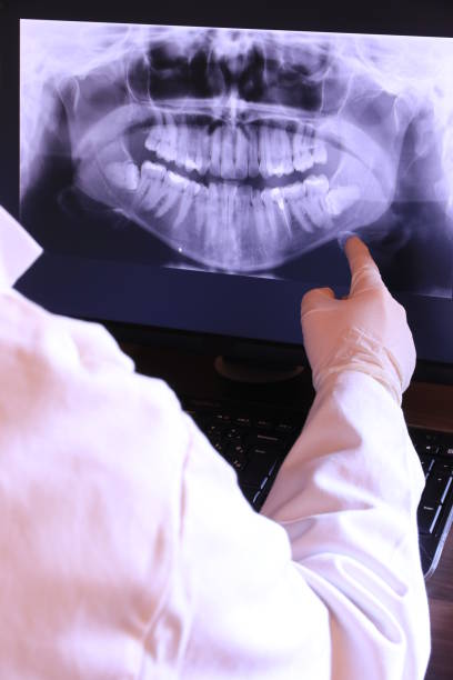 Best Emergency Tooth Extraction  in Fredericksburg, IA